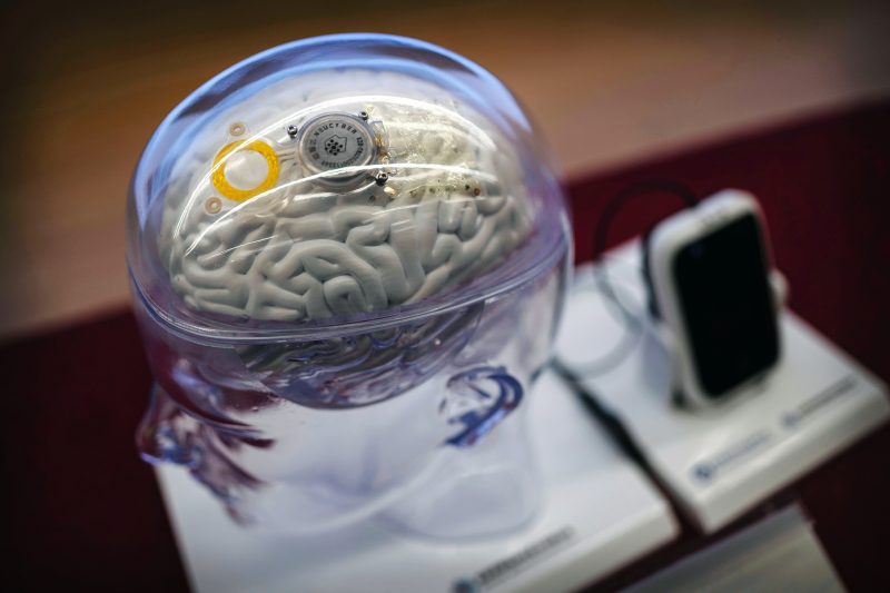 China o ia înaintea lui Elon Musk în cursa cipurilor pe creier. Primul implant cerebral aprobat comercial îi ajută pe pacienții paralizați să-și miște mâna