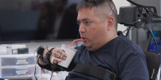 VIDEO | Un bărbat paralizat și-a recăpătat controlul asupra mâinilor cu ajutorul unei noi tehnologii care ar putea schimba viața a milioane de oameni