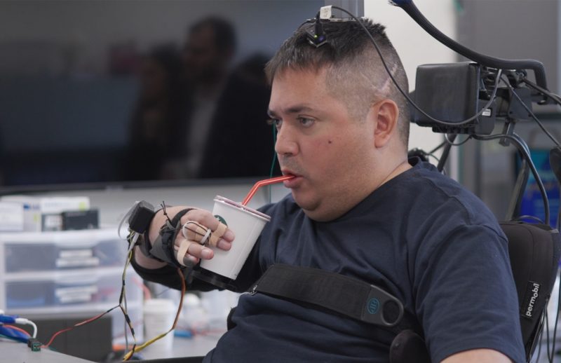 VIDEO | Un bărbat paralizat și-a recăpătat controlul asupra mâinilor cu ajutorul unei noi tehnologii care ar putea schimba viața a milioane de oameni