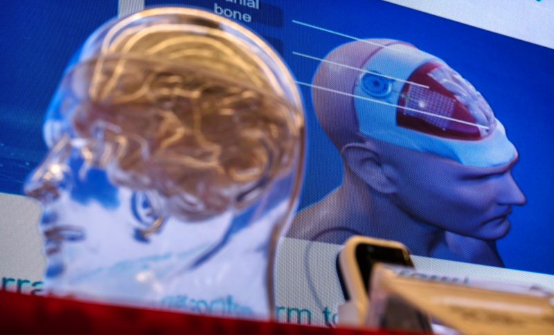 China provoacă Neuralink cu o tehnologie fără operații pe creier. Pariul care poate schimba viitorul implanturilor cerebrale