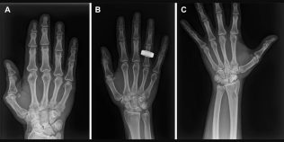 Premieră medicală în spațiu: astronauții au realizat primele radiografii direct pe orbită