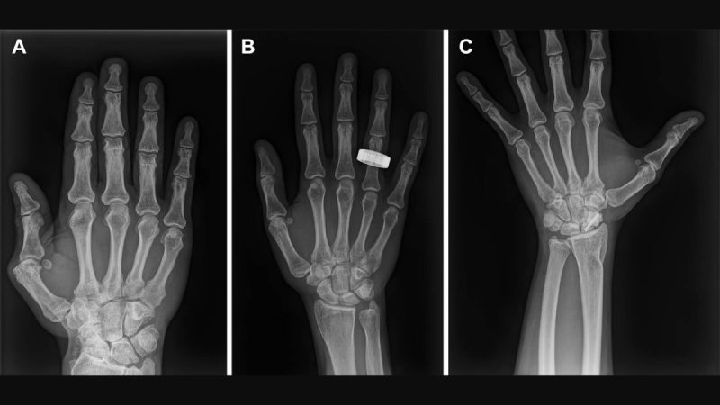 Premieră medicală în spațiu: astronauții au realizat primele radiografii direct pe orbită