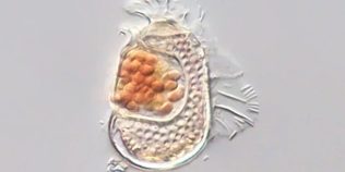 Microbul care împinge viața la limită revine cu o confirmare importantă. Are un genom incredibil de mic și aproape niciun metabolism